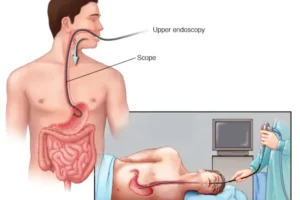 هل تختلف أعراض التهاب البروستاتا من حالة لأخرى